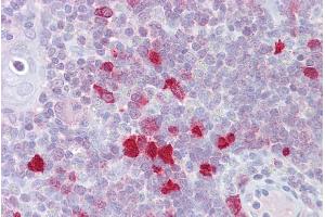 Immunohistochemistry with Thymus tissue at an antibody concentration of 5µg/ml using anti-DLX5 antibody (ARP31607_P050) (DLX5 抗体  (N-Term))