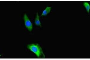 Immunofluorescent analysis of Hela cells using ABIN7171622 at dilution of 1:100 and Alexa Fluor 488-congugated AffiniPure Goat Anti-Rabbit IgG(H+L) (TBC1D24 抗体  (AA 1-169))
