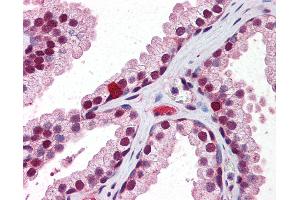Anti-RXRB antibody IHC of human prostate. (Retinoid X Receptor beta 抗体  (AA 74-123))