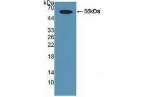 Detection of Recombinant Smad9, Human using Polyclonal Antibody to SMAD family member 9 (SMAD9) (SMAD9 抗体  (AA 226-459))