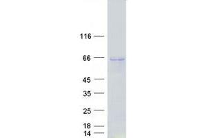 Validation with Western Blot