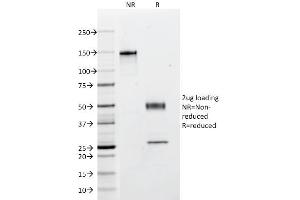 SDS-PAGE Analysis Purified Multi Cytokeratin Mouse Monoclonal Antibody (C11). (KRT4, KRT5, KRT6, KRT8, KRT10, KRT13, KRT18 抗体)