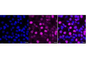 Immunocytochemical staining of HT- cells with Hypoxia inducible factor 1 subunit alpha antibody (ABIN7799017), 1:1,000).