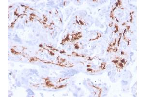 Formalin-fixed, paraffin-embedded human placenta stained with Factor 13A Recombinant Rabbit Monoclonal Antibody (F13A1/3772R).