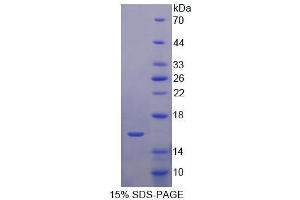 SDS-PAGE analysis of Human KLRK1 Protein. (KLRK1 蛋白)