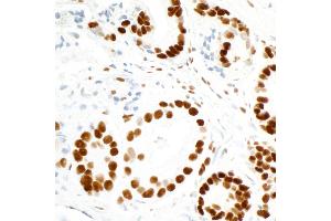 Immunohistochemistry (IHC) image for anti-Fused in Sarcoma (FUS) (AA 1-50) antibody (ABIN7454040) (Recombinant FUS 抗体  (AA 1-50))