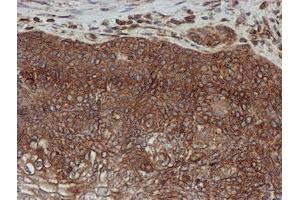 Image no. 7 for anti-Sec1 Family Domain Containing 1 (SCFD1) antibody (ABIN1500818)