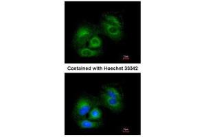 ICC/IF Image Immunofluorescence analysis of methanol-fixed A549, using SIRT3, antibody at 1:200 dilution. (SIRT3 抗体  (C-Term))
