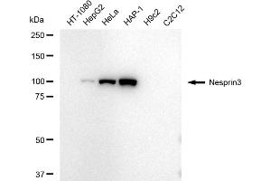anti-Chromosome 14 Open Reading Frame 49 (C14orf49) antibody