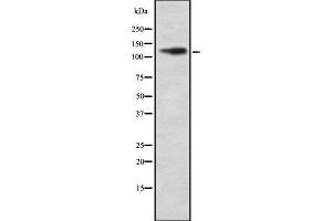 Western blot analysis ITGAD using COLO205 whole cell lysates (ITGAD 抗体  (Internal Region))