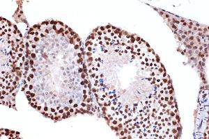 Immunohistochemistry of paraffin-embedded mouse testis using FUBP1 Rabbit mAb (ABIN7267128) at dilution of 1:100 (40x lens). (FUBP1 抗体)