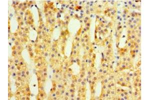 Immunohistochemistry of paraffin-embedded human adrenal gland tissue using ABIN7142344 at dilution of 1:100 (MRPL1 抗体  (AA 51-324))