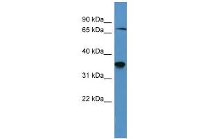 Western Blotting (WB) image for anti-SH3-Domain Binding Protein 5 (SH3BP5) (C-Term) antibody (ABIN2788422) (SH3BP5 抗体  (C-Term))