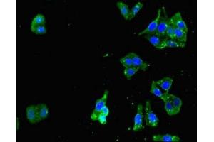 Immunofluorescent analysis of HepG2 cells using ABIN7167639 at dilution of 1:100 and Alexa Fluor 488-congugated AffiniPure Goat Anti-Rabbit IgG(H+L) (RENT1/UPF1 抗体  (AA 956-1125))