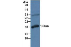 Detection of KLK2 in Rat Prostate Gland Tissue using Polyclonal Antibody to Kallikrein 2 (KLK2) (Kallikrein 2 抗体  (AA 19-261))