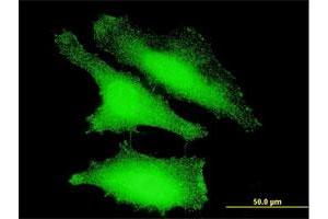Immunofluorescence of monoclonal antibody to FOXO1 on HeLa cell. (FOXO1 抗体  (AA 556-655))