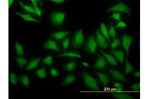 Immunofluorescence of monoclonal antibody to ARF5 on HeLa cell. (ARF5 抗体  (AA 81-180))