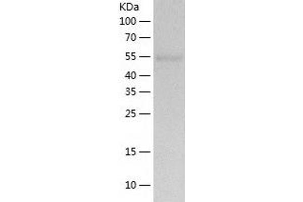 TBC1D22B Protein (AA 1-505) (His tag)