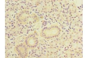 Immunohistochemistry (IHC) image for anti-TBC1 Domain Family, Member 9B (With GRAM Domain) (TBC1D9B) (AA 724-1023) antibody (ABIN7171662)