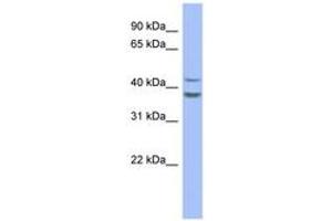 Image no. 1 for anti-Plasminogen Activator Inhibitor 2 (SERPINB2) (AA 179-228) antibody (ABIN6744064) (SERPINB2 抗体  (AA 179-228))