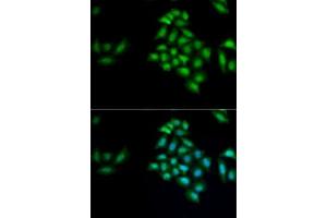 Immunofluorescence analysis of MCF7 cells using KLK10 antibody (ABIN6142943). (Kallikrein 10 抗体  (AA 35-276))