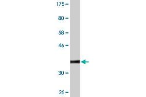 Western Blot detection against Immunogen (37. (MAP3K7 抗体  (AA 471-579))