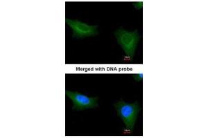 ICC/IF Image Immunofluorescence analysis of paraformaldehyde-fixed HeLa, using TTLL1, antibody at 1:200 dilution. (TTLL1 抗体)