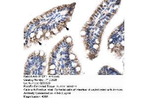 Human Intestine (DP1 抗体  (N-Term))