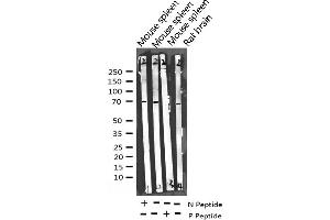 Western blot analysis of Phospho-Merlin (Ser518) expression in various lysates (Merlin 抗体  (pSer518))