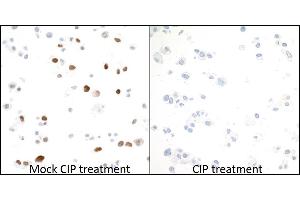 Immunocytochemistry (ICC) image for anti-Minichromosome Maintenance Complex Component 2 (MCM2) (pSer53) antibody (ABIN7449430) (Recombinant MCM2 抗体  (pSer53))