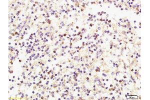 Formalin-fixed and paraffin embedded human spleen labeled with Anti-CXCL9/MIG Polyclonal Antibody, Unconjugated  at 1:200 followed by conjugation to the secondary antibody and DAB staining. (CXCL9 抗体  (AA 23-125))