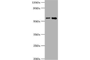 Western blot All lanes: IL1R1 antibody at 6 μg/mL Lane 1: Hela whole cell lysate Lane 2: Mouse heart tissue Secondary Goat polyclonal to rabbit IgG at 1/10000 dilution Predicted band size: 65 kDa Observed band size: 65 kDa (IL1R1 抗体  (AA 18-320))