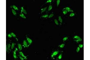 Immunofluorescent analysis of Hela cells using ABIN7143166 at dilution of 1:100 and Alexa Fluor 488-congugated AffiniPure Goat Anti-Rabbit IgG(H+L) (Activator of Basal Transcription 1 抗体  (AA 197-270))