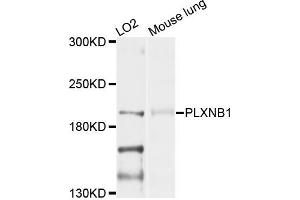 Western blot analysis of extracts of LO2 and mouse lung cells, using PLXNB1 antibody. (PLXNB1 抗体)