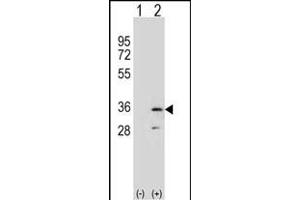 Western blot analysis of R (arrow) using rabbit polyclonal R Antibody (N-term) (ABIN653060 and ABIN2842661). (RPA2 抗体  (N-Term))