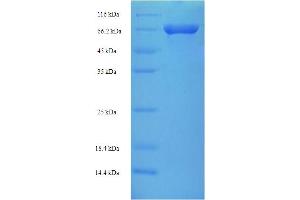SDS-PAGE (SDS) image for VPS33B Interacting Protein, Apical-Basolateral Polarity Regulator (VIPAR) (AA 1-493), (full length) protein (His-SUMO Tag) (ABIN5711925)