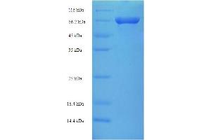 VIPAR Protein (AA 1-493, full length) (His-SUMO Tag)