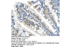 Immunohistochemistry (IHC) image for anti-Nucleus Accumbens Associated 1, BEN and BTB (POZ) Domain Containing (NACC1) (C-Term) antibody (ABIN2778437)