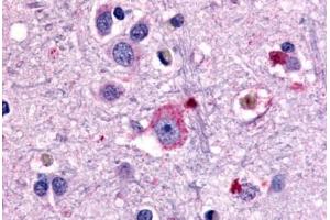 Anti-GRM1 / MGLUR1 antibody  ABIN1048925 IHC staining of human brain, neurons and glia. (Metabotropic Glutamate Receptor 1 抗体  (N-Term))