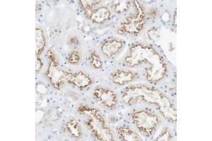 Immunohistochemical staining of human kidney with SPOCD1 polyclonal antibody  shows moderate luminal membrane positivity in cells of tubules at 1:50-1:200 dilution. (SPOCD1 抗体)
