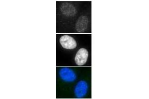 Immunofluorescence (IF) image for anti-DNA Repair Protein Homolog 1 (RAD51) antibody (ABIN2452093) (RAD51 抗体)