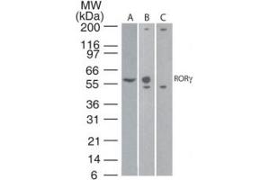 Image no. 1 for anti-RAR-Related Orphan Receptor C (RORC) (AA 1-50) antibody (ABIN959913) (RORC 抗体  (AA 1-50))