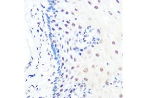 Immunohistochemistry (IHC) image for anti-Kruppel-Like Factor 4 (Gut) (KLF4) antibody (ABIN7268157)