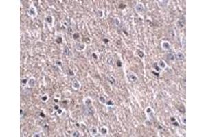 Immunohistochemistry of FNIP2 in mouse brain tissue with FNIP2 antibody at 2. (CDIP1 抗体  (Center))