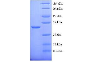 SDS-PAGE (SDS) image for Cytochrome P450, Family 21, Subfamily A, Polypeptide 2 (CYP21A2) (AA 2-261) protein (His tag) (ABIN5713302) (CYP21A2 Protein (AA 2-261) (His tag))