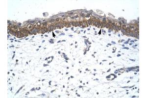 ZNF385 antibody was used for immunohistochemistry at a concentration of 4-8 ug/ml to stain Epidermal cells (arrows) in Human Skin. (ZNF385A 抗体  (C-Term))