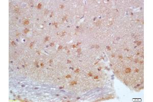 Formalin-fixed and paraffin embedded rat brain labeled with Anti-Calbindin/Calbindin D28k Polyclonal Antibody, Unconjugated (ABIN703691) at 1:200 followed by conjugation to the secondary antibody and DAB staining (CALB1 抗体)