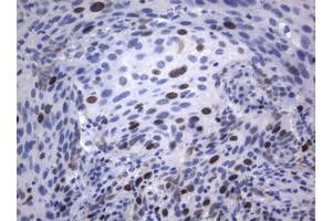 Image no. 3 for anti-Antigen Identified By Monoclonal Antibody Ki-67 (MKI67) (AA 1160-1493) antibody (ABIN1490860)