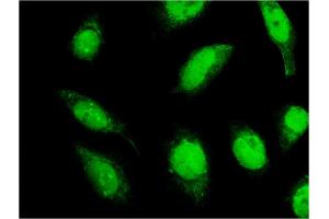 Immunofluorescence of monoclonal antibody to C18orf23 on HeLa cell. (C18orf23 抗体  (AA 122-220))