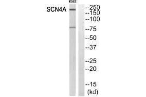 Western blot analysis of extracts from K562 cells, using SCN4A antibody. (SCN4A 抗体)